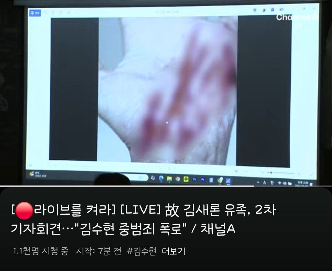 가세연 피습사진 당한 사진 공개.jpg